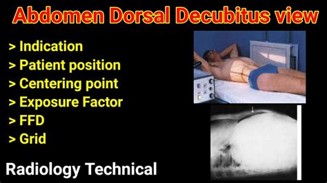 Abdomen Dorsal Decubitus X Ray Abdomen Radiography Part 4 By Bl