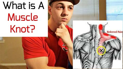 What Is A Muscle Knot Youtube