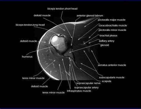 Anatomy of the human body. shoulder anatomy | mri shoulder axial anatomy | free cross ...