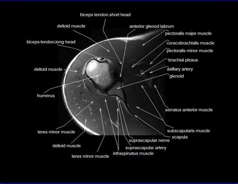 12 photos of the foot muscle anatomy mri. shoulder anatomy | mri shoulder axial anatomy | free cross ...