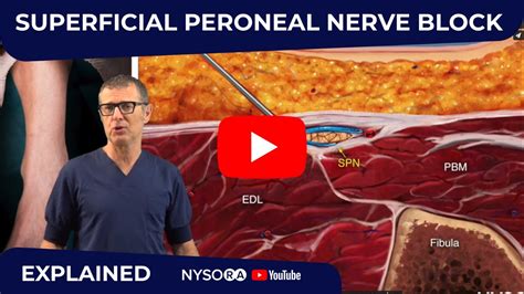 Superficial Peroneal Nerve Block Crash Course With Dr Hadzic Nysora