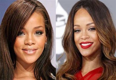 Rihanna Plastic Surgery Making Her More And More Beautiful