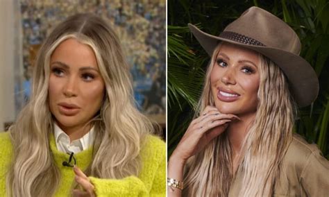 Olivia Attwood Breaks Silence On Why She Left Im A Celebrity