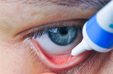 Ophthalmic Ointment Definition And Uses All About Vision