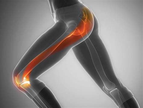Iliotibial Band Syndrome Itbs