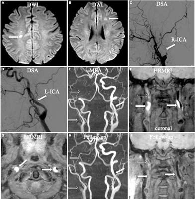 Frontiers Three Dimensional High Resolution Magnetic Resonance Imaging For The Assessment Of