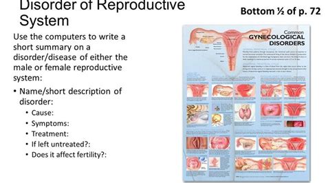 Female Reproductive System Disorders And Diseases Presentation Set Up Cornell Notes On Pg Topic