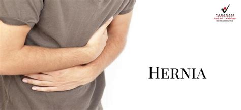 Let Us Get To Know Some Common Facts About A Hernia