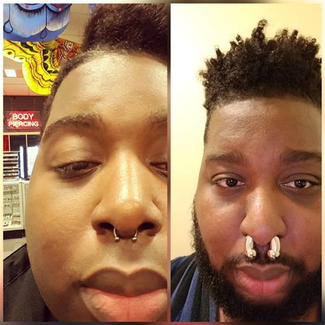 My 00g Septum Before And After Rpiercing