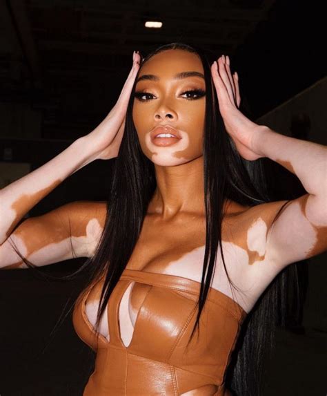 Winnie Harlow Nude 2023 11 Photos The Fappening