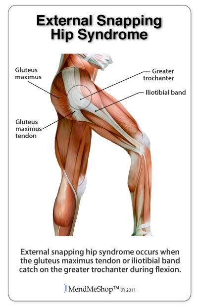 Muscle anatomy made simple, cincinnati, oh. Hip and groin - Platinum Physiotherapy