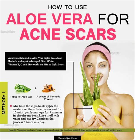 Aloe Vera For Acne Scars Benefits And How To Use It