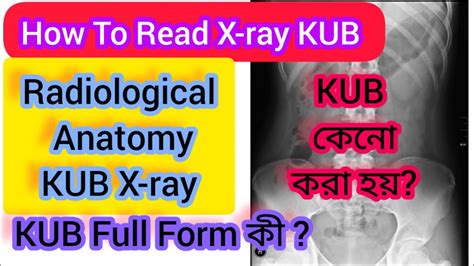 How To Read X Ray Kubradiological Anatomy Kub X Raybengali ️ ️