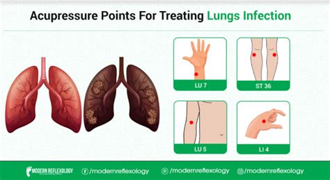 4 Effective Acupressure Points For Treating Lung Infection Modern