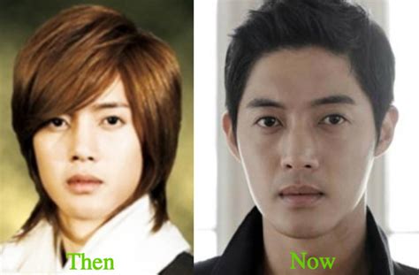 Kim Hyun Joong Plastic Surgery Before And After Photos Latest Plastic Surgery Gossip And News