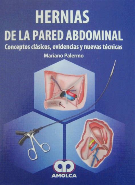 Hernias De La Pared Abdominal Conceptos Clásicos Evidencias Y Nuevas