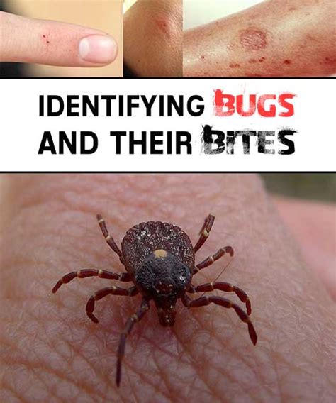 The best way to prevent these tiny bugs that bite like mosquitoes is to be. Identifying Bugs and Their Bites - iSeeiDoiMake