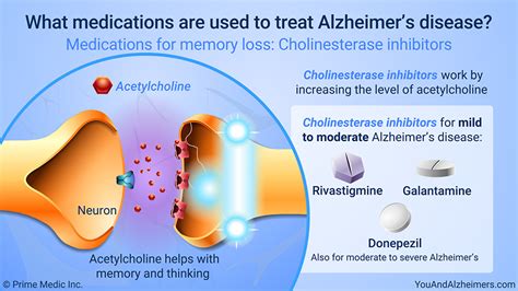 Slide Show Managing And Treating Alzheimers Disease
