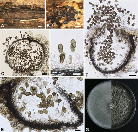 Phaeobotryon Rhois BJFC S Holotype A B Habit Of Conidiomata Download Scientific