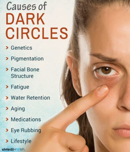 Possible Causes Of Dark Circles And Treatment Options