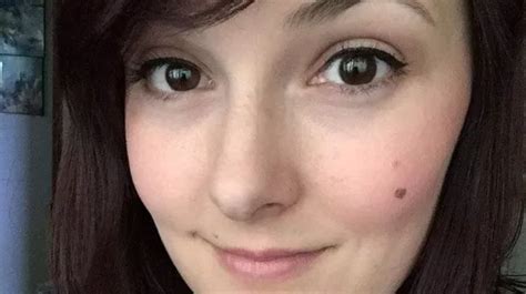 Womans Super Cute Heart Shaped Freckle Turns Out To Be Aggressive