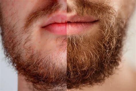 good beards vs bad beards beards base