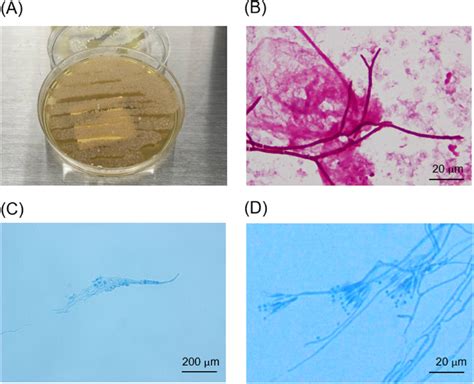 A Subculturing Of The Organism Isolated From Blood Culture On