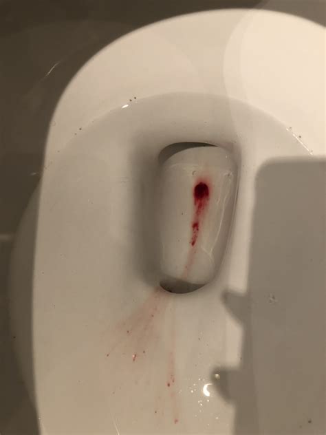 Could This Be Implantation Bleeding Pls Help