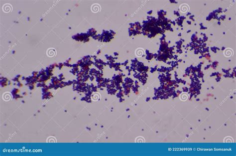 Gram Positive Cocci Finding With Microscope Stock Image Image Of