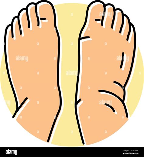 Swollen Ankles Feet Disease Symptom Color Icon Vector Illustration Stock Vector Image And Art Alamy