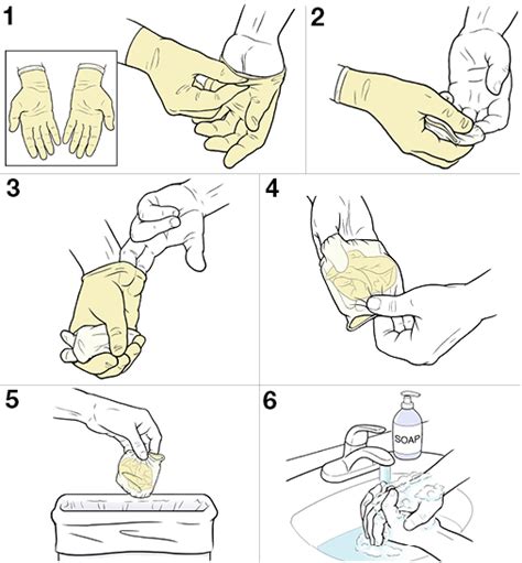 Step By Step Sterile Technique For Taking Off Gloves Saint Lukes