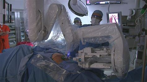 Cleveland Clinic Shows Progress In Prostate Cancer Removal With Improved Robotic Surgery Youtube