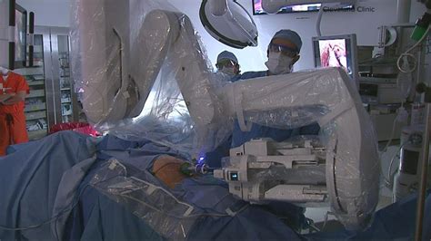 Cleveland Clinic Shows Progress In Prostate Cancer Removal With Improved Robotic Surgery YouTube