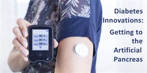 Diabetes And Innovation Insulin Pumps Cgms Artificial Pancreas