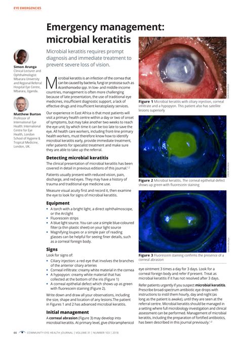 Use this emergency management resume template to highlight your key skills, accomplishments, and work experiences. (PDF) Emergency management: microbial keratitis