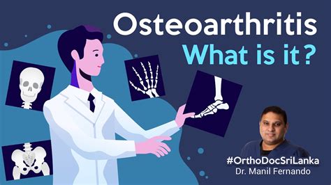 Osteoarthritis What Is It Youtube