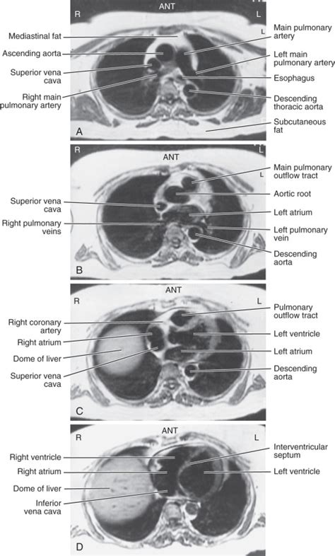 Cardiovascular System Radiology Key