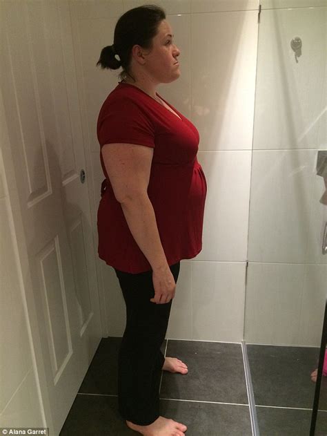 brisbane mother loses 54kgs after getting gastric sleeve daily mail online