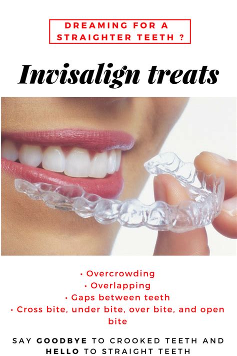The Number One Benefit Of Invisalign Is That Its Discreet The Clear Aligners Are Virtually