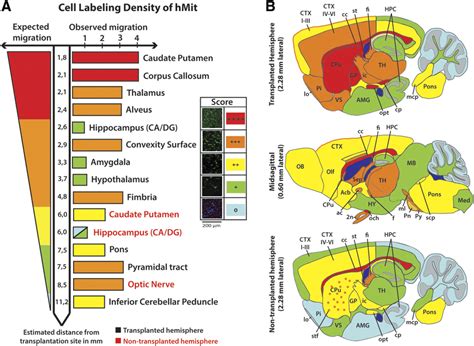 Tumor Cell Distribution In Different Brain Regions A Schematic