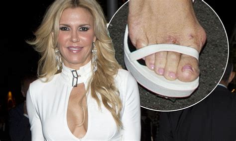 This will allow you to search for titles that have another person in the cast. Brandi Glanville reveals severe bunions and blisters on ...
