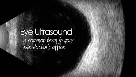 Eye Ultrasound A Patients Guide