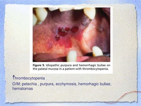 Basics Of Dentistry