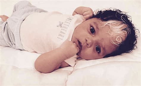 Upbeat News This Baby Was Born With White Hair And Doctors Had No Idea Why