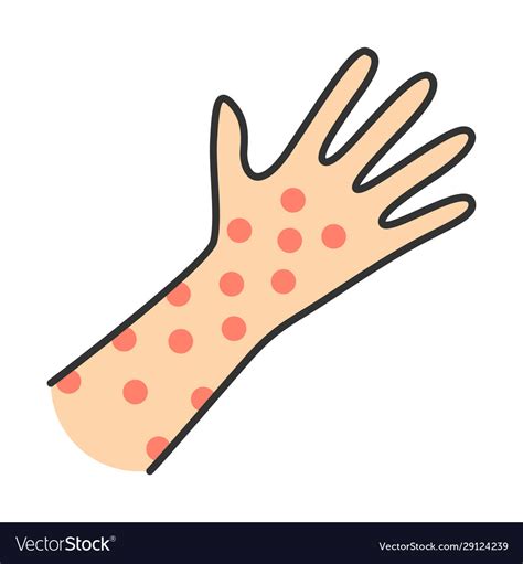 Urticaria Hives And Allergic Skin Rashes Illustration High Res Vector