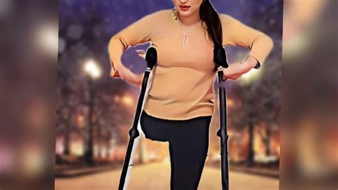 A Beautiful Woman With An Amputated Leg Walks Briskly With Crutches😍🌼🦋