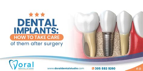 Dental Implants How To Take Care Of Them After Surgery Doral Dental
