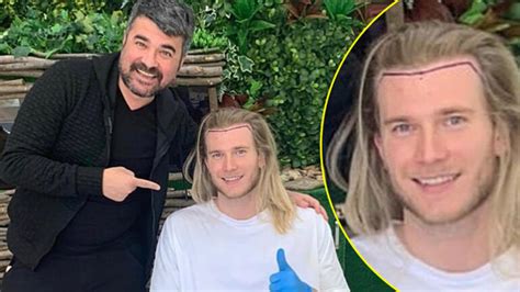 Banyodan yeni çıkmış rıdavn dilmen saçı çok fönlü. Loris Karius saç ektirdi! - F5Haber