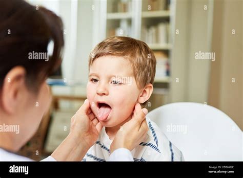 Tonsils And Tongue Hi Res Stock Photography And Images Alamy