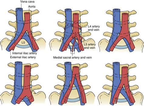 Lumbar And Sacral Spine Neupsy Key